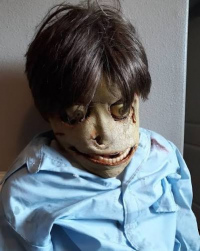 Паралич Церебральный